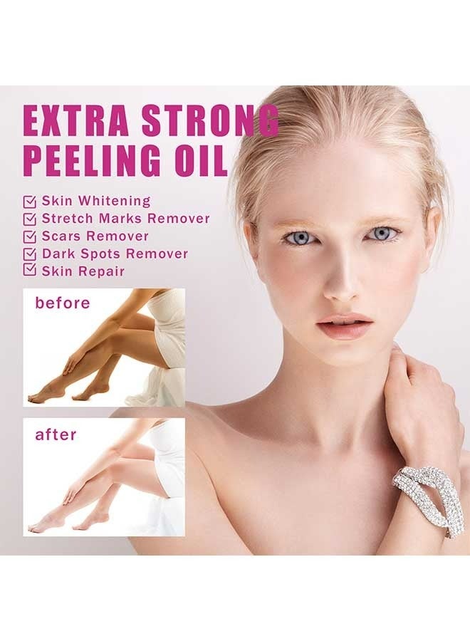 OUHOE 2Pcs Extra Strong Peeling Oil (30ml+110ml), Exfoliate Dark Skin, Super Whiten And Brighten Skin Tone, Exfoliating Peeling Solution for Body All Skin Type  - Image 3