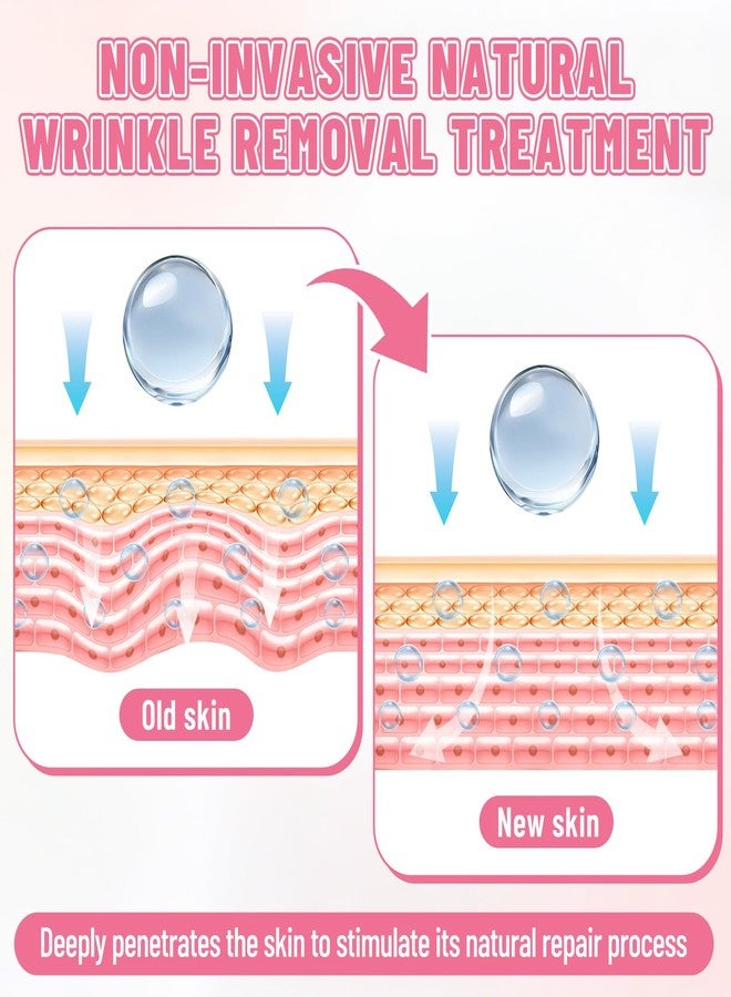 AOBEN 4 PCS Neck Wrinkle Patches, Reusable Night Silicone Anti-Wrinkle Patches, Effectively Locks in Moisture, Improves Wrinkles and Restores Skin Firmness. (3-5 Month Supply) - Image 4
