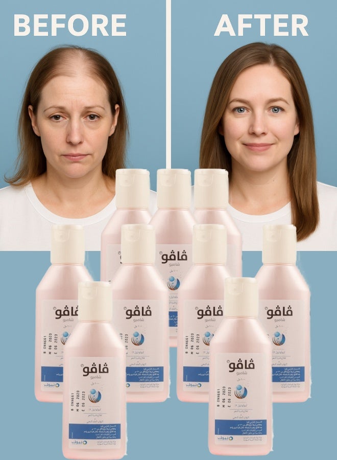 فافو 9 قطع فافو 2% شامبو 100مل - Image 1