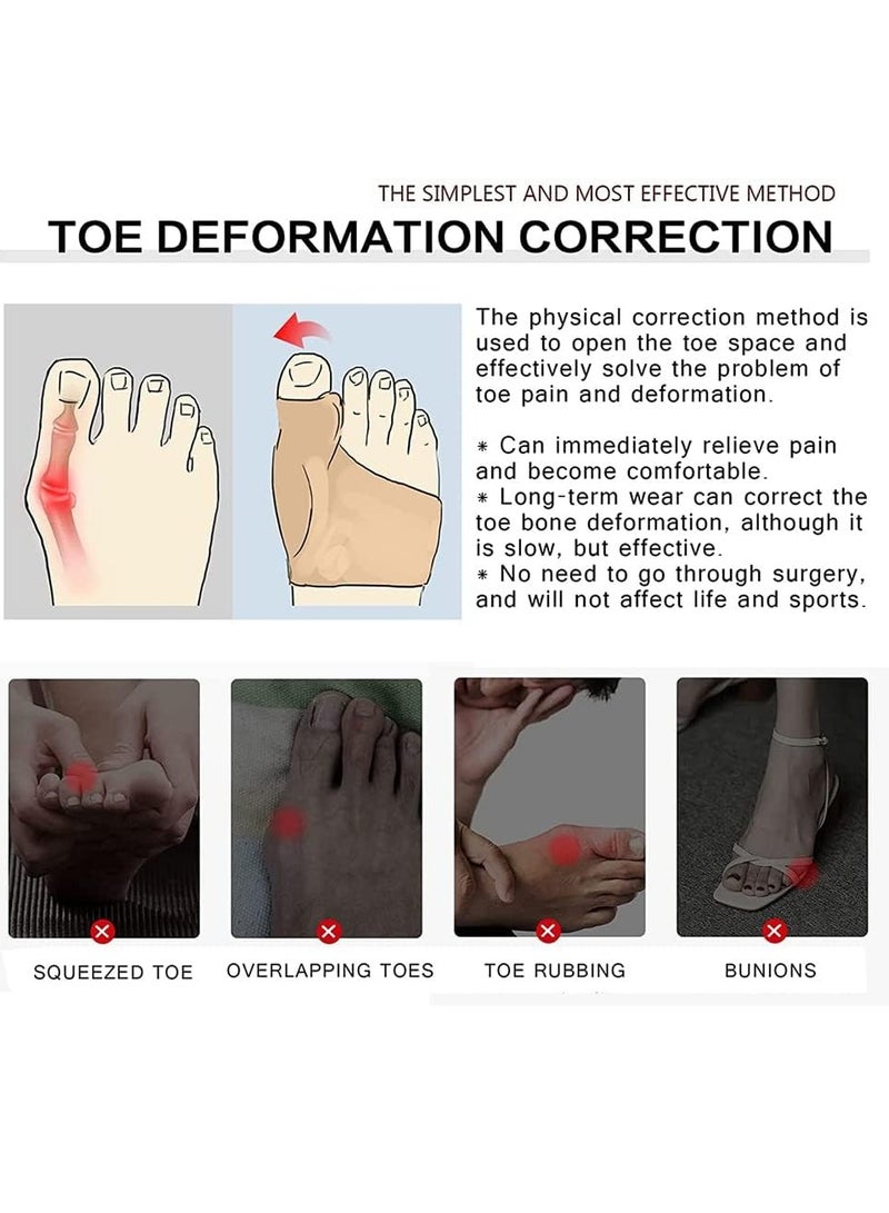 GUDOO 4 عبوات من الأكمام الفاصلة لأصابع القدم، مصحح ناعم لأصابع القدم الكبيرة مع وسادة فاصل من الجل لأصابع القدم، أكمام متداخلة لأصابع القدم، بيج S - Image 5