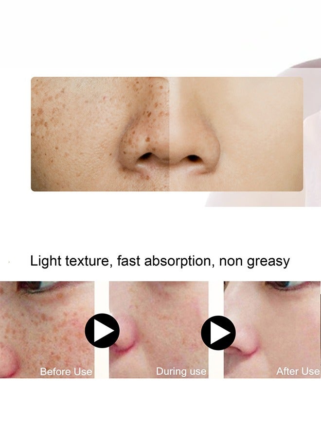 EELHOE Whitening Freckle Cream,Dark Spot Corrector Remover Cream Whitening Moisturizing Brighten Complexion Improving Skin Barrier 20g  - Image 2