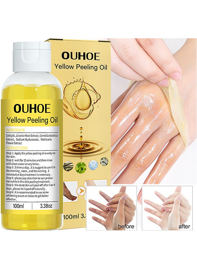 OUHOE 100ML Super Strength Yellow Peeling Oil Exfoliating Dark Skin For Body, Yellow Peeling Oil Body Whitening Skins, Butter Peeling Lightening Brighten Complexion For Cleansing And Moisturizing - Image 1