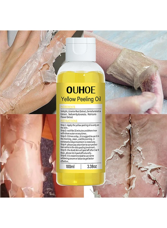 OUHOE 100ML Super Strength Yellow Peeling Oil Exfoliating Dark Skin For Body, Yellow Peeling Oil Body Whitening Skins, Butter Peeling Lightening Brighten Complexion For Cleansing And Moisturizing - Image 3