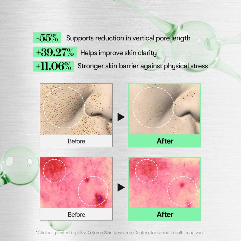 VT COSMETICS CICA Reedle Shot 100, Spicule Microneedling Serum for Pore Care & Exfoliation, Exosome, Centella Asiatica for Glass Skin, Skin Texture, Korean Liquid Skin Booster (1.69 Fl Oz / 50ml) - Image 4