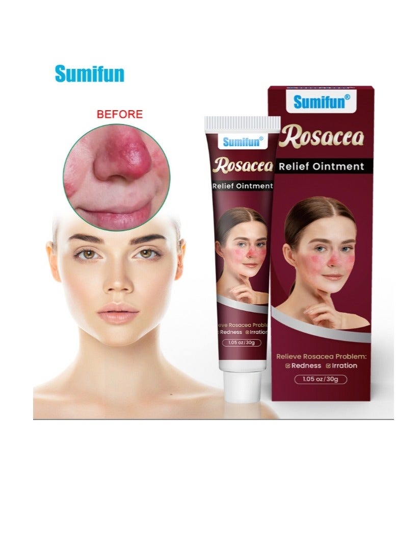 Sumifun Rosacea Treatment Face Cream Red Nose Redness Relief Acne Cream 30g - Image 1