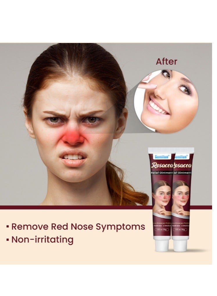 Sumifun Rosacea Treatment Face Cream Red Nose Redness Relief Acne Cream 30g - Image 3