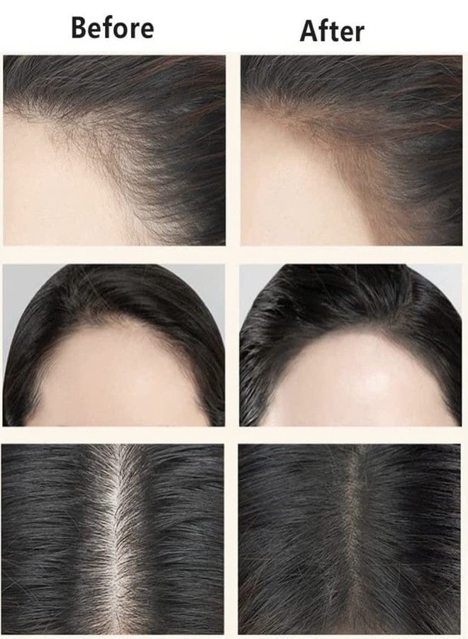 CELLEBII® Natural Shade Hairline Powder, Hair Shading Sponge Pen, Hairline Shadow Powder Stick, Quick Root Touch-Up, Waterproof Hair Root Concealer For Thinning Hair(Black & Brown) - Image 3