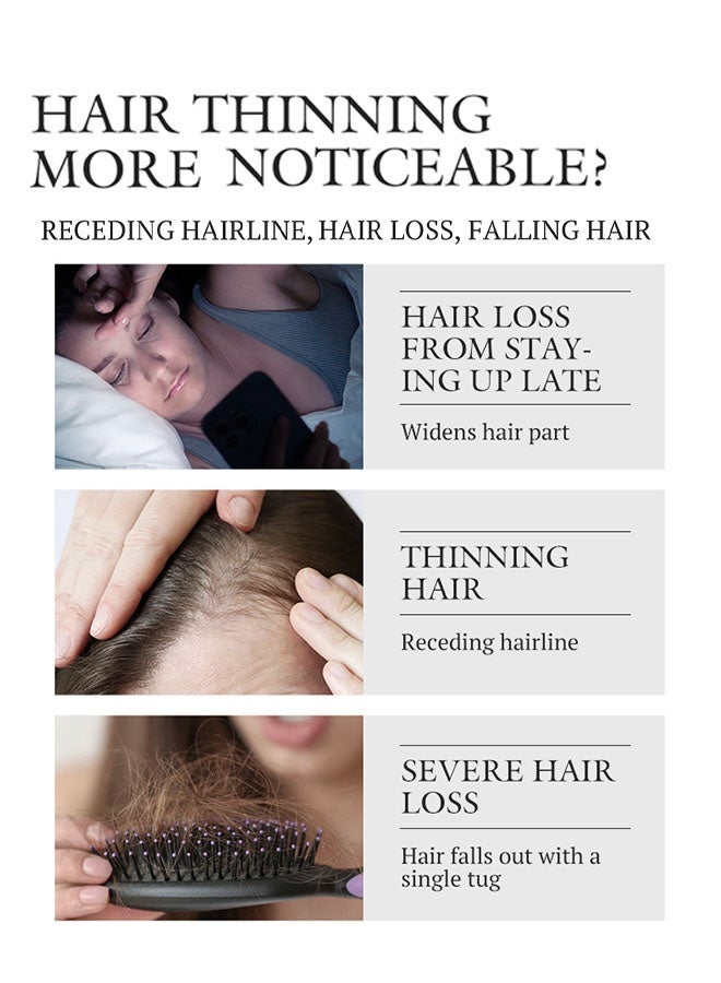 Kormesic سيروم نمو الشعر مينوكسيديل 5٪، للرجال والنساء، علاج نمو الشعر واللحية مع البيوتين وإكليل الجبل لعلاج ترقق وتساقط الشعر 30 مل - عبوتان - Image 2