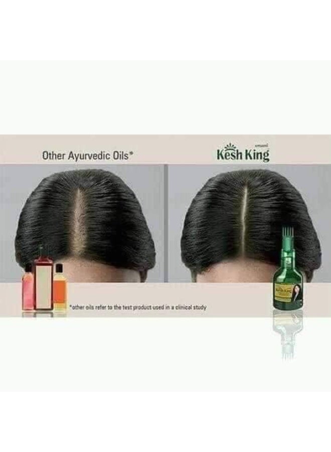 كيش كينج زيت كيش كينج الأصلي سر كثافة وطول الشعر بالأعشاب الهندية - Image 2