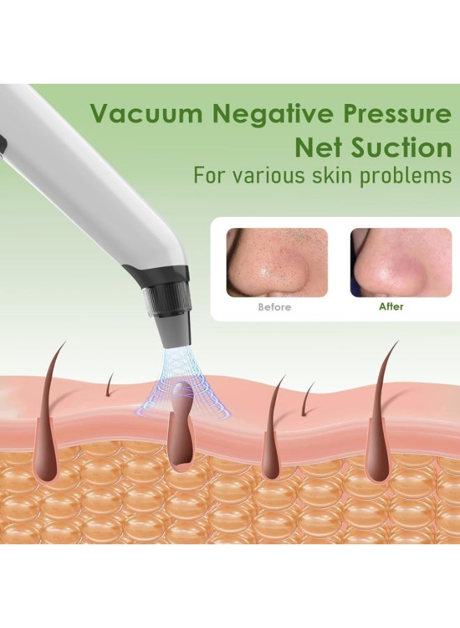 Blackhead Remover Vacuum, Blackhead Extractor Pore Vacuum Hot Compress, Electric Acne Comedone Whitehead Remover Tools - 4 Suction Power with LED Display, Rechargeable Pimple Popper Tool Kit - Image 4
