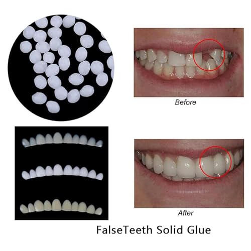 DAONPHARI Moldable Teeth Veneers with Adhesive Fitting Beads Temporary False Teeth |Health & Beauty | Oral Care | Whitening (30 Gm) - Image 5