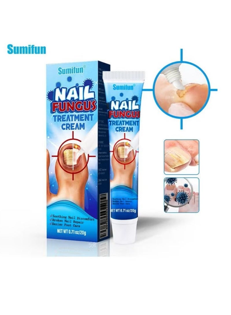 Sumifun Nail Fungus Treatment Cream 20g, Bad Nail Care Ointment, Nail Fungus Treatment, Nail Growth and Repair, Nail Treatment Repair Cream - Image 1
