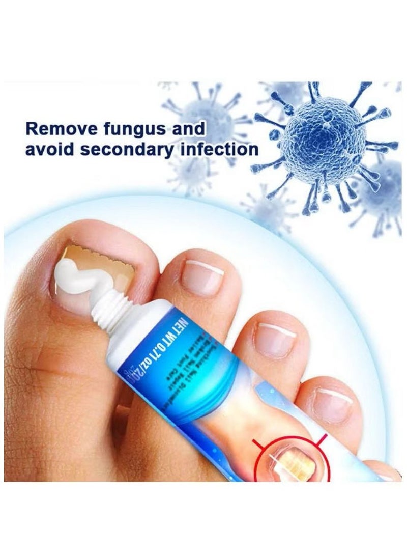 Sumifun Nail Fungus Treatment Cream 20g, Bad Nail Care Ointment, Nail Fungus Treatment, Nail Growth and Repair, Nail Treatment Repair Cream - Image 5