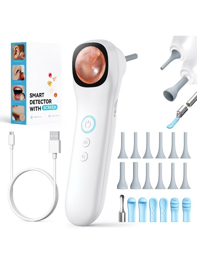 M MIAOYAN 5-in-1 Digital Otoscope with Screen, 1080P HD Ear Camera, 4X Magnification, Rechargeable Ear Wax Removal Tool for Ear, Nose, Skin Inspection - Image 1