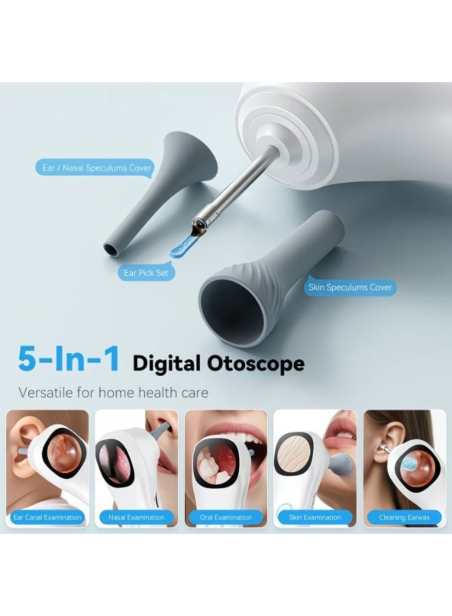 M MIAOYAN 5-in-1 Digital Otoscope with Screen, 1080P HD Ear Camera, 4X Magnification, Rechargeable Ear Wax Removal Tool for Ear, Nose, Skin Inspection - Image 2