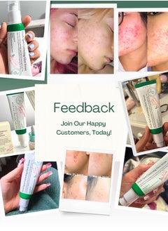 AXIS-Y Axis-Y Dark Spot Correcting Glow Serum - Radiant Skin with Even Tone - Brightens and Fades Dark Spots  - Image 4