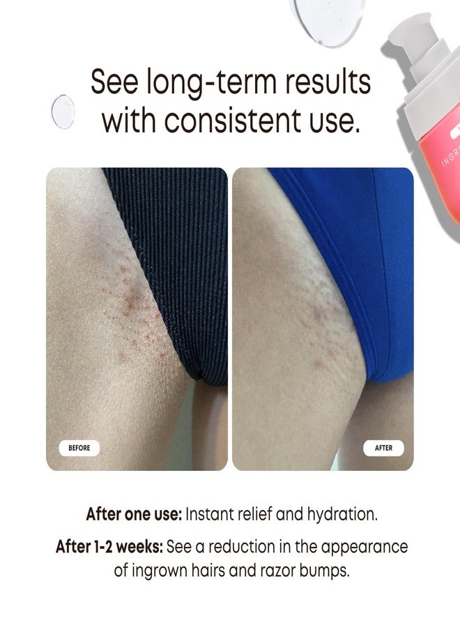 Bushbalm Ingrown Hair 2 Step Routine - Moisturize and Soothe - Ingrown Hair Oil (30 ml), Exfoliating Scrub (236 ml) - Watermelon Sugar - Valued at $49 - Image 2