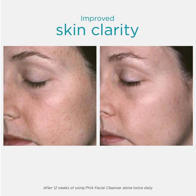 NEOSTRATA PHA Facial Cleanser Gentle Gel Facial Wash Soap-free Fragrance-free For Sensitive and Reactive Skin Types, 6.8 Fl Oz (Pack of 1) - Image 3