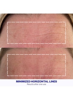 WRINKLES SCHMINKLES Forehead Wrinkle Patches, 4-Pack, Reusable Hypoallergenic Silicone Smoothing Pads for Reducing Frown Lines & Face Lift Overnight  - Image 2