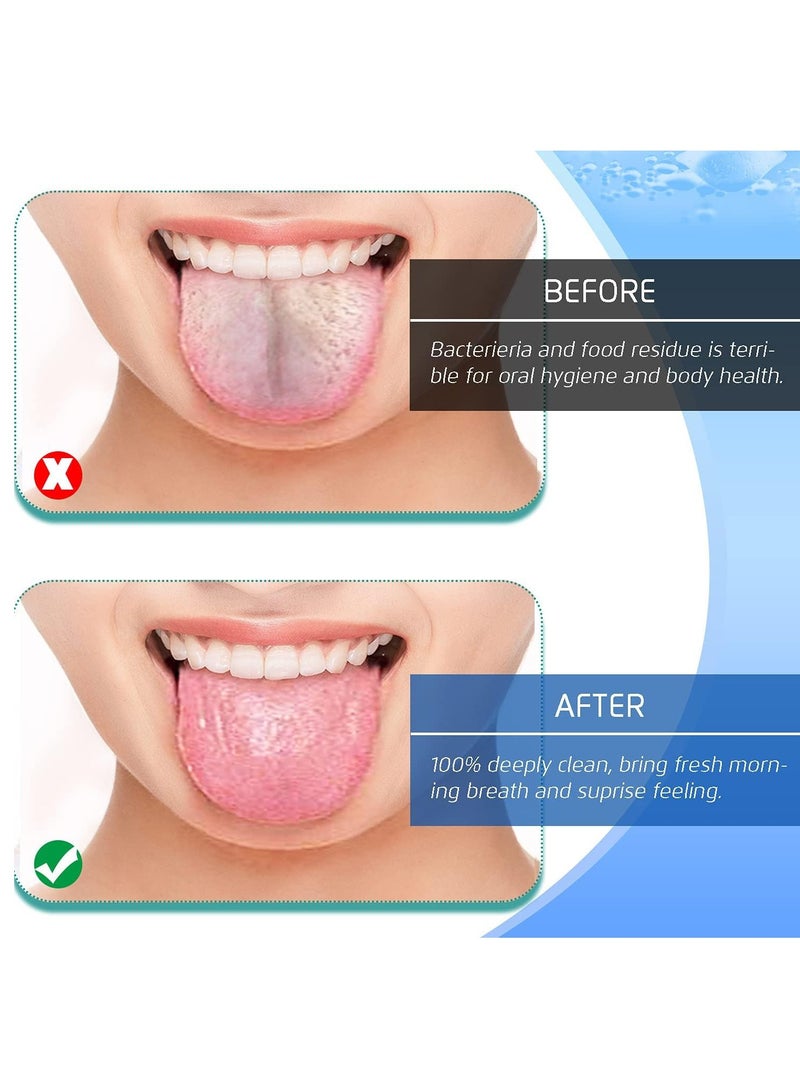 SYOSI مكشطة اللسان 4 قطع من منظفات اللسان المصنوعة من الفولاذ المقاوم للصدأ خالية من مادة BPA بنسبة 100% وأدوات تنظيف اللسان الأكثر انتعاشًا وفرش نظافة الفم الصحية من الدرجة الطبية القابلة لإعادة الاستخدام من الفولاذ المقاوم للصدأ للتخلص من رائحة الفم الكريهة - Image 3