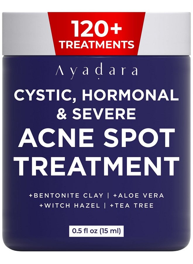 AYADARA Cystic Acne Spot Treatment 120+ Treatments Overnight Cystic Acne Treatment For Hormonal And Severe Acne Overnight Results On Stubborn Acne Spots & Blemishes  - Image 2