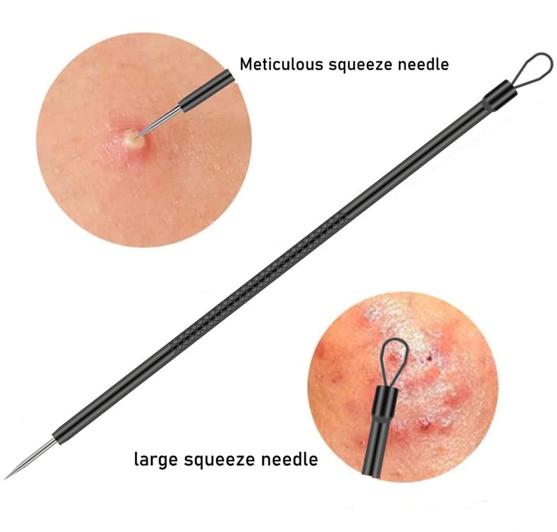 TULOBI Blackhead Remover Pimple Popper Tool Kit 4 Pcs Acne Comedone Zit Blackhead Extractor Tool for Nose Face,Stainless Steel Whitehead Popping Removal Tool Set - Image 5