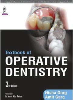 Textbook of Operative Dentistry India Ed 3 