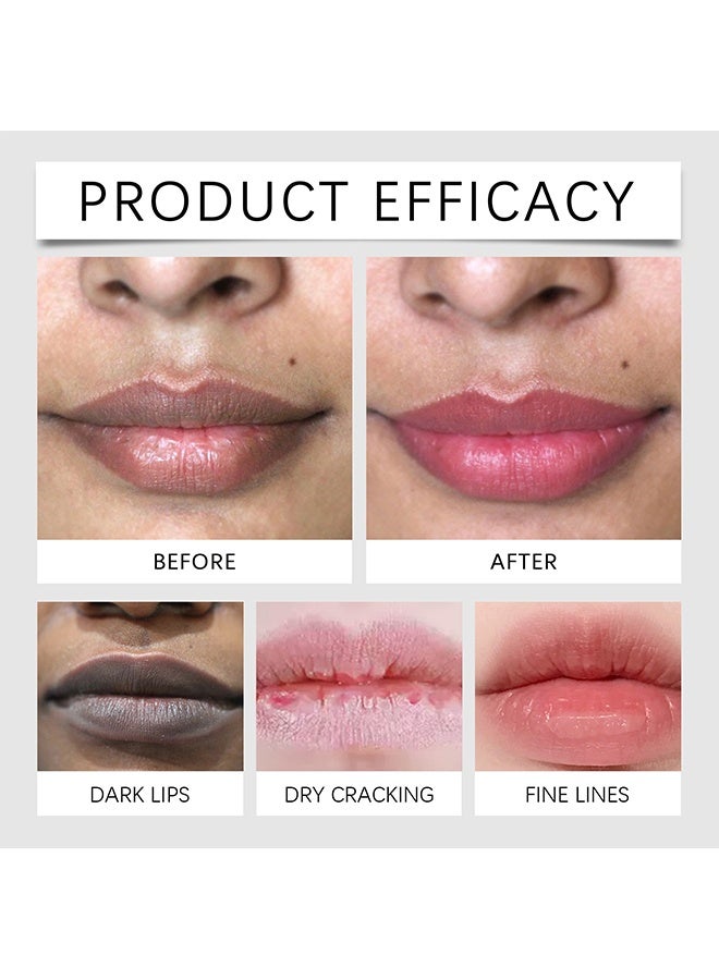 OUHOE Lip Lightening Cream - for Dark Lips Lip Brightener, Help fade lip discoloration with Alpha Arbutin & Licorice Extract | Scented 10ml - Image 2