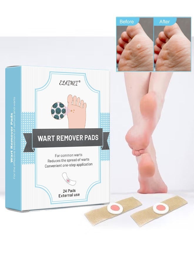 إليمي 24 قطعة من وسادات مزيل الثآليل ، جص الذرة الثآليل القوية لإزالة الثآليل على القدمين وأصابع القدم واليدين ، تصميم ذاتي اللصق نتائج سريعة مريحة ، العناية بالقدم - Image 1
