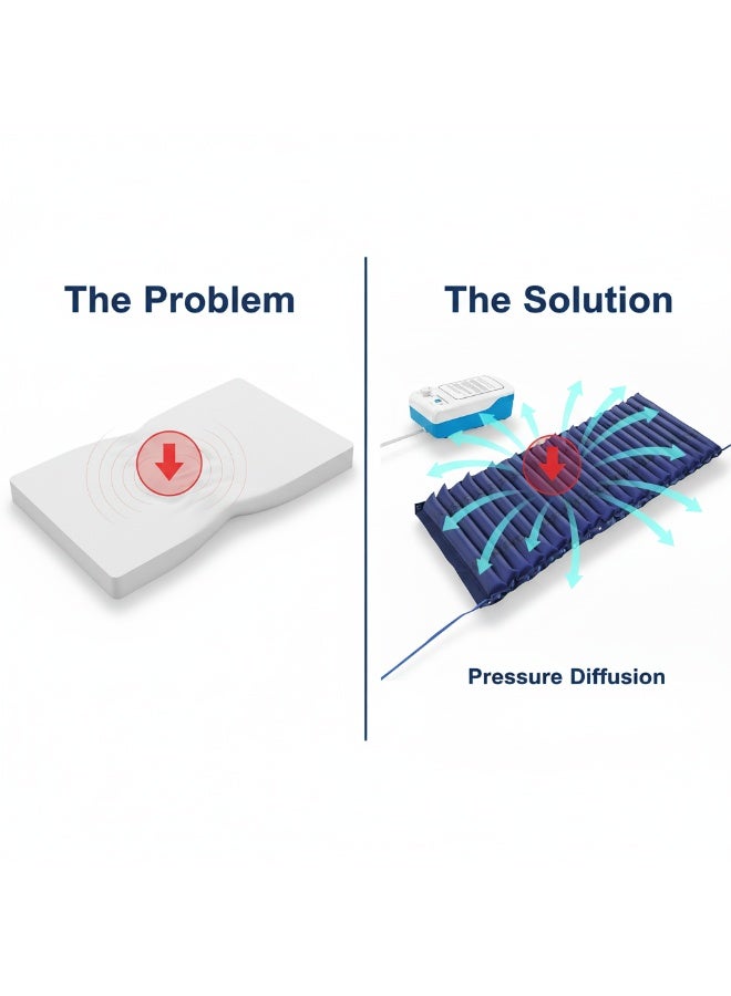 HT Anti-Bedsore Mattress with 3 Positions - The Ultimate Home Care Solution. Intelligent Alternating Pressure Technology for Pain Relief and Blood Circulation. - Image 5