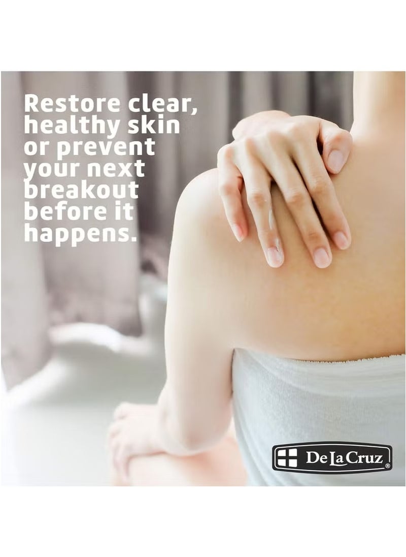 De La Cruz Acne Treatment Ointment with 10% Sulfur(73.7 g)  - Image 4