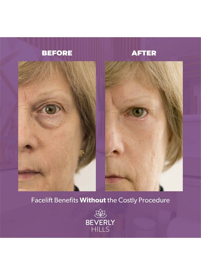 Beverly Hills Instant Facelift Anti Aging Eye Serum Treatment For Dark Circles, Puffy Eyes, Wrinkles, Under Eye Bags, Fine Lines, And Crows Feet | 30Ml (120 Days Supply)  - Image 4