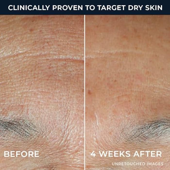 RoC Hydration+ Hyaluronic Acid Serum for Face, Hydrating, Plumping, Fragrance Free, Lightweight Formula with Collagen Proteins (1 Ounce) with Retinol Eye Cream Packette - Image 4