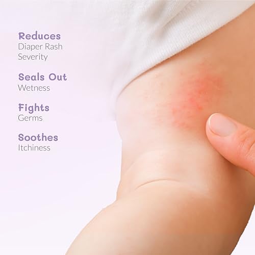 AreoVeda Diaper Rash Cream (50 gm), Suitable for newborns & babies, 15% Zinc Oxide, Prevents & Soothes Rashes from Day 1, Relieves Itchiness & Discomfort - Image 3