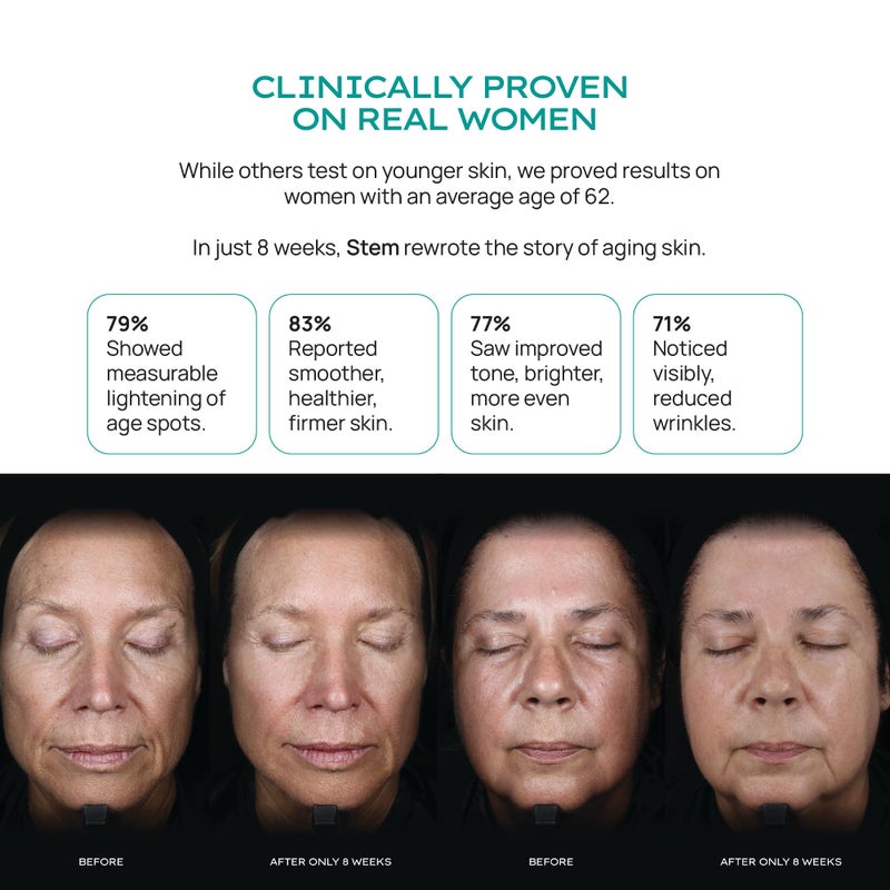 STEM Natural Intelligence ReSet Moisturizing Facial Spray, Setting Spray for Makeup, Makeup Setting Spray for Luxury Skin Care, Face Moisturizer for Women, Finishing Spray for Makeup, 1 oz - Image 5