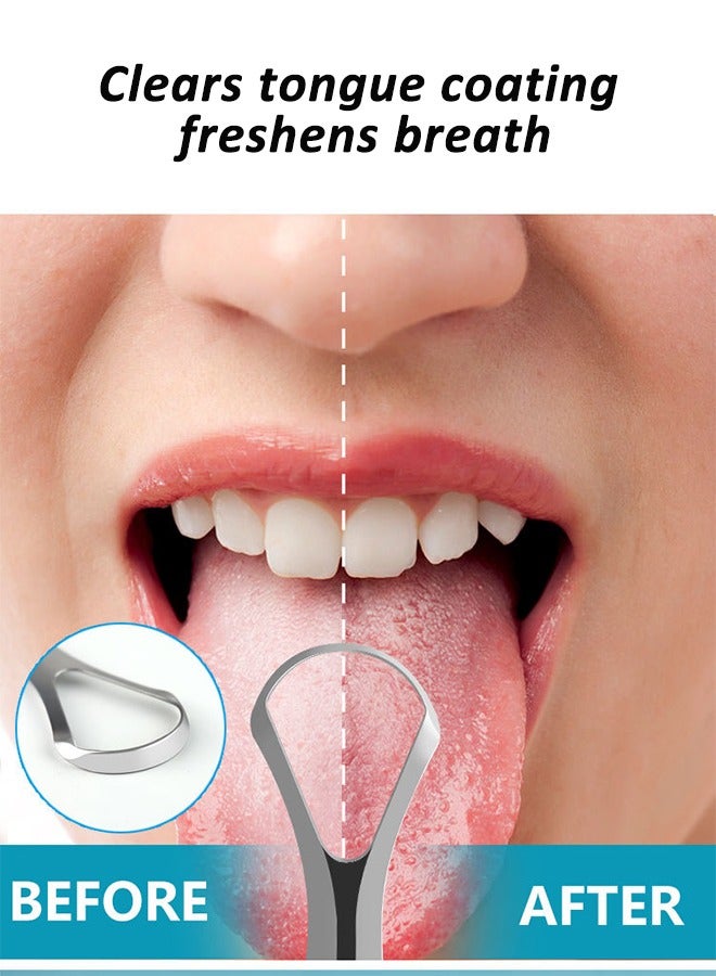 Generic Tongue Scraper Tongue Cleaner Stainless Steel Tongue Scrapers,Professional Tongue Cleaners  - Image 1