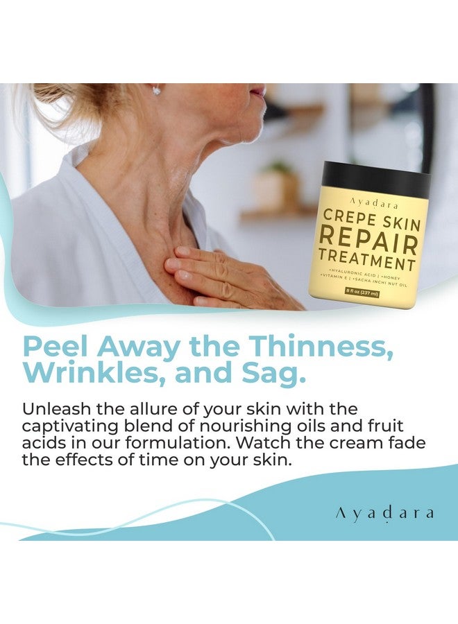 ايدارا علاج أيادارا لإصلاح البشرة المتجعدة، 8 أونصة، لوشن لشد البشرة المترهلة، كريم كولاجين لتصحيح التجاعيد لشد بشرة الجسم، كريم للتجاعيد للوجه والرقبة والذراعين والساقين، أكثر من 500 استخدام - Image 3