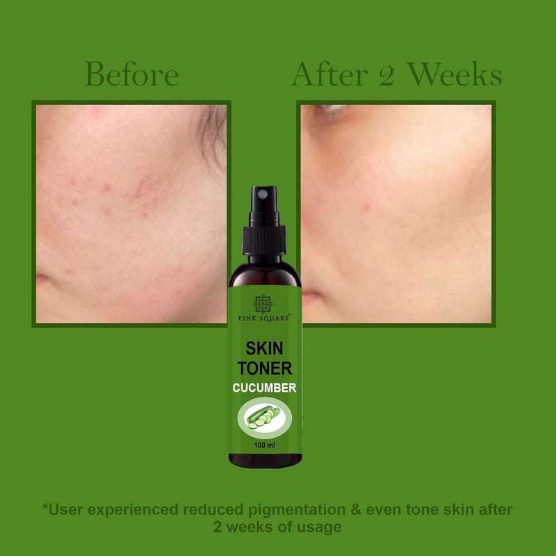 Pink Square Cucumber Face Toner Refreshing Face Mist  Toner  Toner for Hydrating Skin  AlcoholFree Mist  toner for open pores Tightening Pack of 4 of 100 ML - Image 5