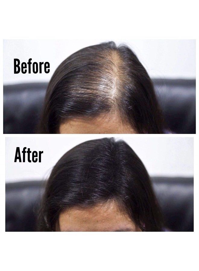 Thick Fiber THICK FIBER Hair Fibers for Thinning Hair & Bald Spots (BLACK) - 25g Bottle - Conceals Hair Loss in Seconds - Hair Powder for Women & Men  - Image 5