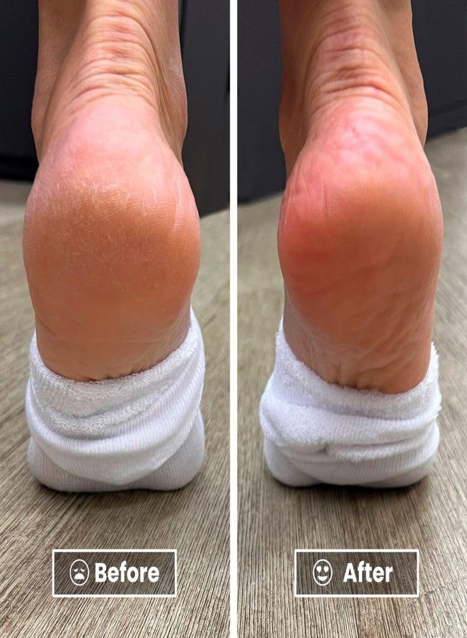 LONDONTOWN Pedikur Foot Balm Restorative Smoother Soles & Softer Heels, Vegan & Cruelty Free, 4 fl oz - Image 3