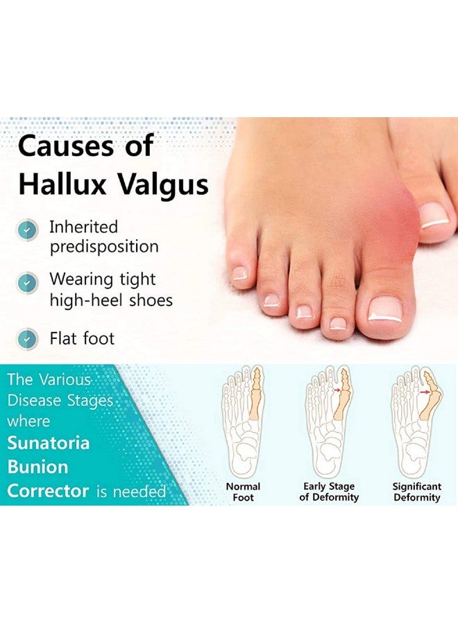 NUCARTURE Nucarture toe separator for women men toe straightener for feet big toe protector for pain relief silicone toe spreader guards  - Image 3