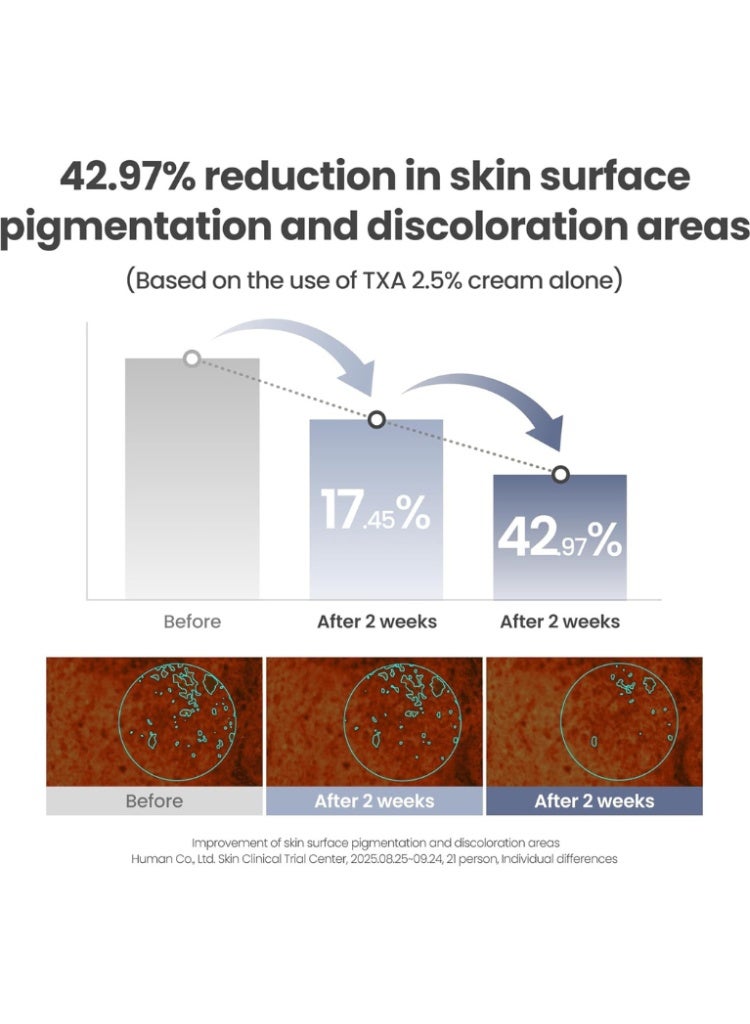 AXIS-Y TXA 2.5% Intensive Brightening Cream – Korean Brightening Face Cream for Dark Spots & Uneven Skin Tone - Image 5
