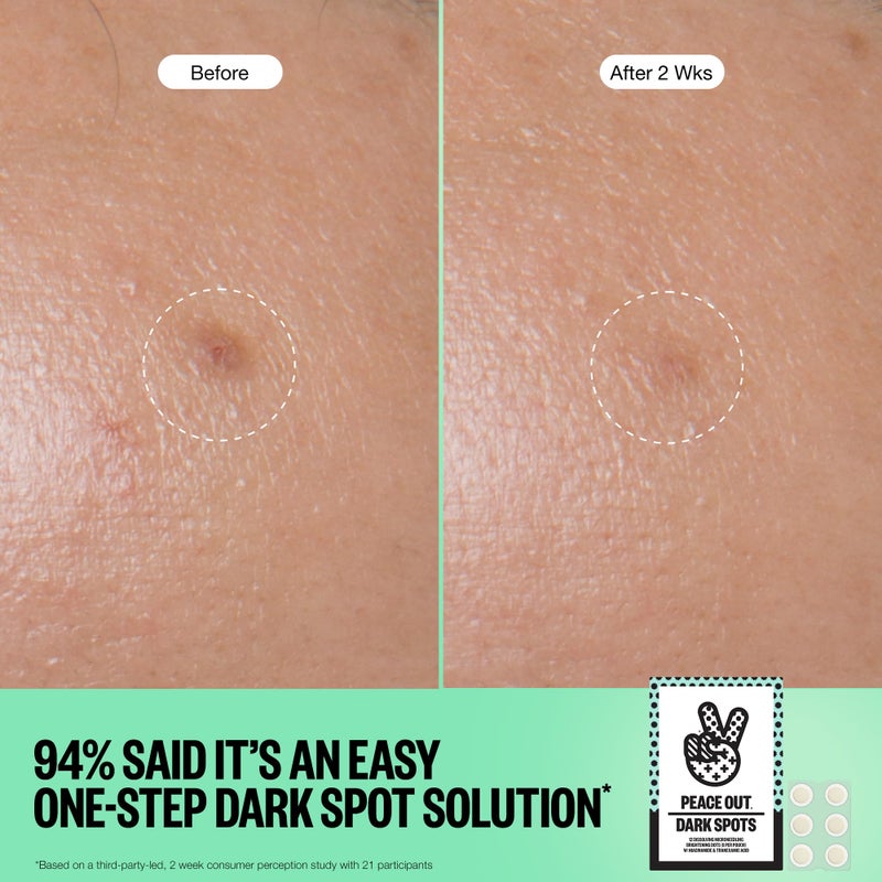 PEACE OUT Microneedling Dark Spot Brightening Dots - Image 4