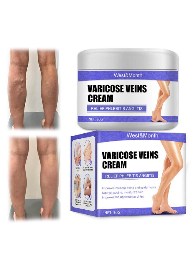 West&Month Varicose Veins Cream Eliminate And Spider Veins, Varicose Veins Relief Cream, Improve Blood Circulation, Soothes Tired Legs - Image 1