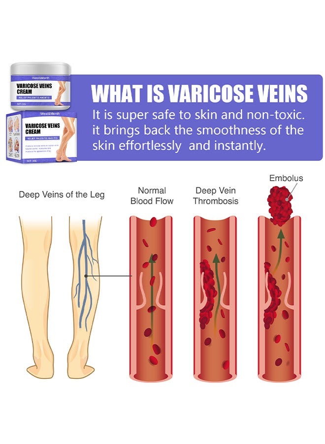 West&Month Varicose Veins Cream Eliminate And Spider Veins, Varicose Veins Relief Cream, Improve Blood Circulation, Soothes Tired Legs - Image 3