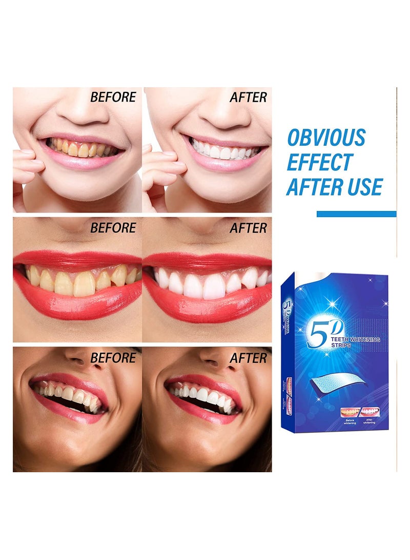 Generic 56 pcs Teeth Whitening Strips, Teeth Whitening Teeth Whitening Agent (28 Sets)  - Image 4