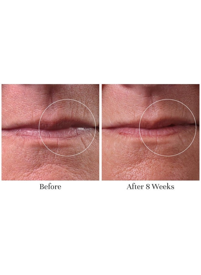 City Beauty City Lips Line Therapy - Lip Line Fortifying Treatment - Defining & Smoothing - Solution for Lipstick Lines, Vertical Wrinkles, Corner Creases - Anti-Aging Cruelty-Free Skin Care - Image 4