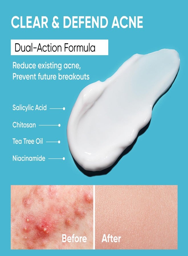 AOBBIY Butt Acne Clearing Treatment Cream: Clears & Prevents Breakouts – Gentle Body & Back Treatment for Clogged Pores, Folliculitis & Bumps - Image 3