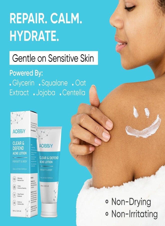 AOBBIY Butt Acne Clearing Treatment Cream: Clears & Prevents Breakouts – Gentle Body & Back Treatment for Clogged Pores, Folliculitis & Bumps - Image 4