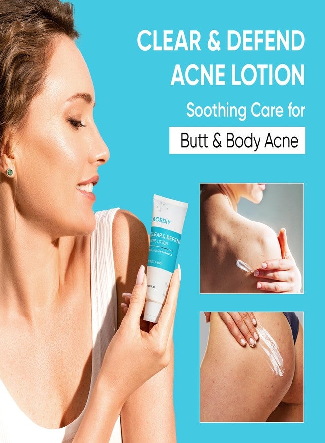 AOBBIY Butt Acne Clearing Treatment Cream: Clears & Prevents Breakouts – Gentle Body & Back Treatment for Clogged Pores, Folliculitis & Bumps - Image 2